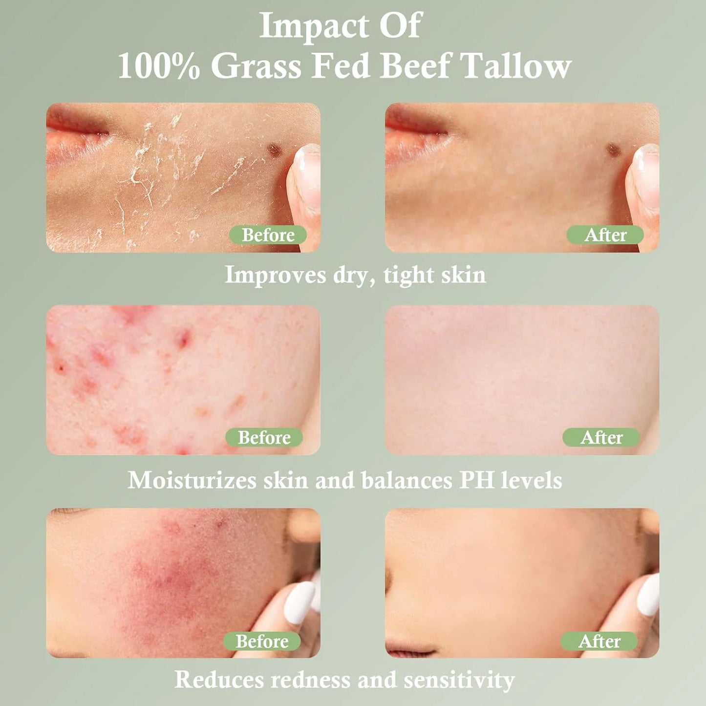 Grass-Fed Tallow Moisturizing Cream – Soothing & Nourishing Skincare